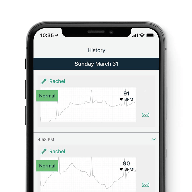 AliveCor KardiaMobile 6L | FDA-Cleared | Wireless 6-Lead EKG | Detects AFib or Normal Heart Rhythm in 30 Seconds Electronics > Computers > Handheld Devices AliveCor   