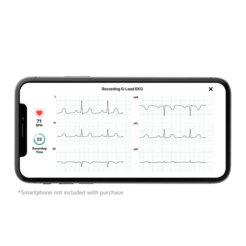 AliveCor KardiaMobile 6L | FDA-Cleared | Wireless 6-Lead EKG | Detects AFib or Normal Heart Rhythm in 30 Seconds