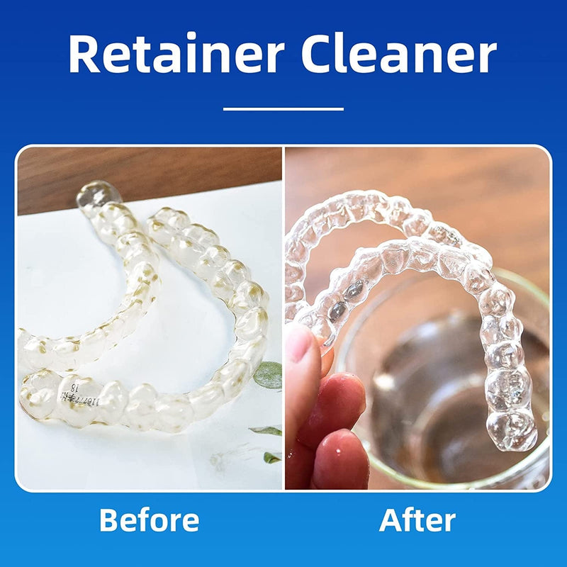 PROJECT BETTER Retainer Cleaner Tablets & Denture Cleaning Tablets for Dental Appliances and Night & Mouth Guard.(36 Counts Home & Garden > Household Supplies > Household Cleaning Supplies Better Project Co. LLC   